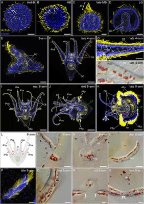 Developmental atlas of the indirect-developing sea urchin Paracentrotus lividus: From fertilization to juvenile stages